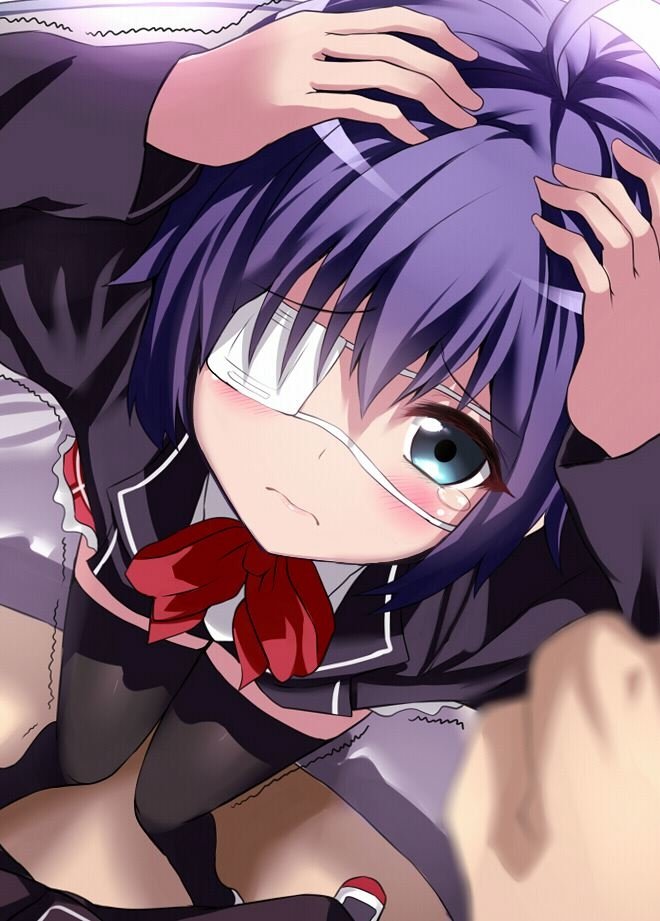 Rikka Takanashi from Love Chunibyo & Other Delusions, wearing a distinctive eye patch, looks upward with a shy expression, her purple hair and school uniform visible.